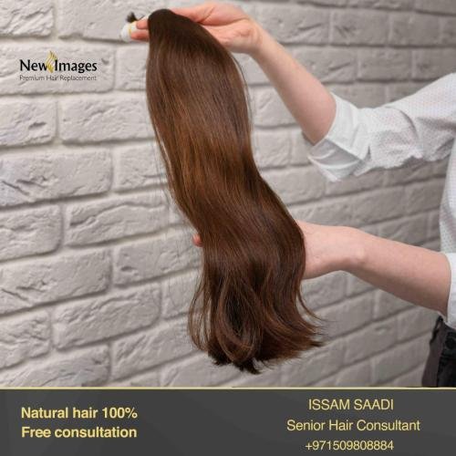 hair replacement in dubai