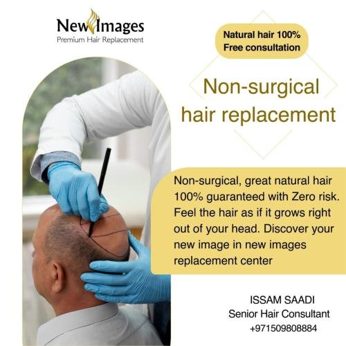 hair replacement in dubai